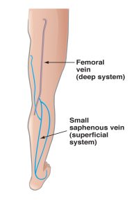Alpha_Vein_Clinic_Back_of_Leg_Vein_Anatomy_Las_Vegas_Dr._Sassan_Kaveh